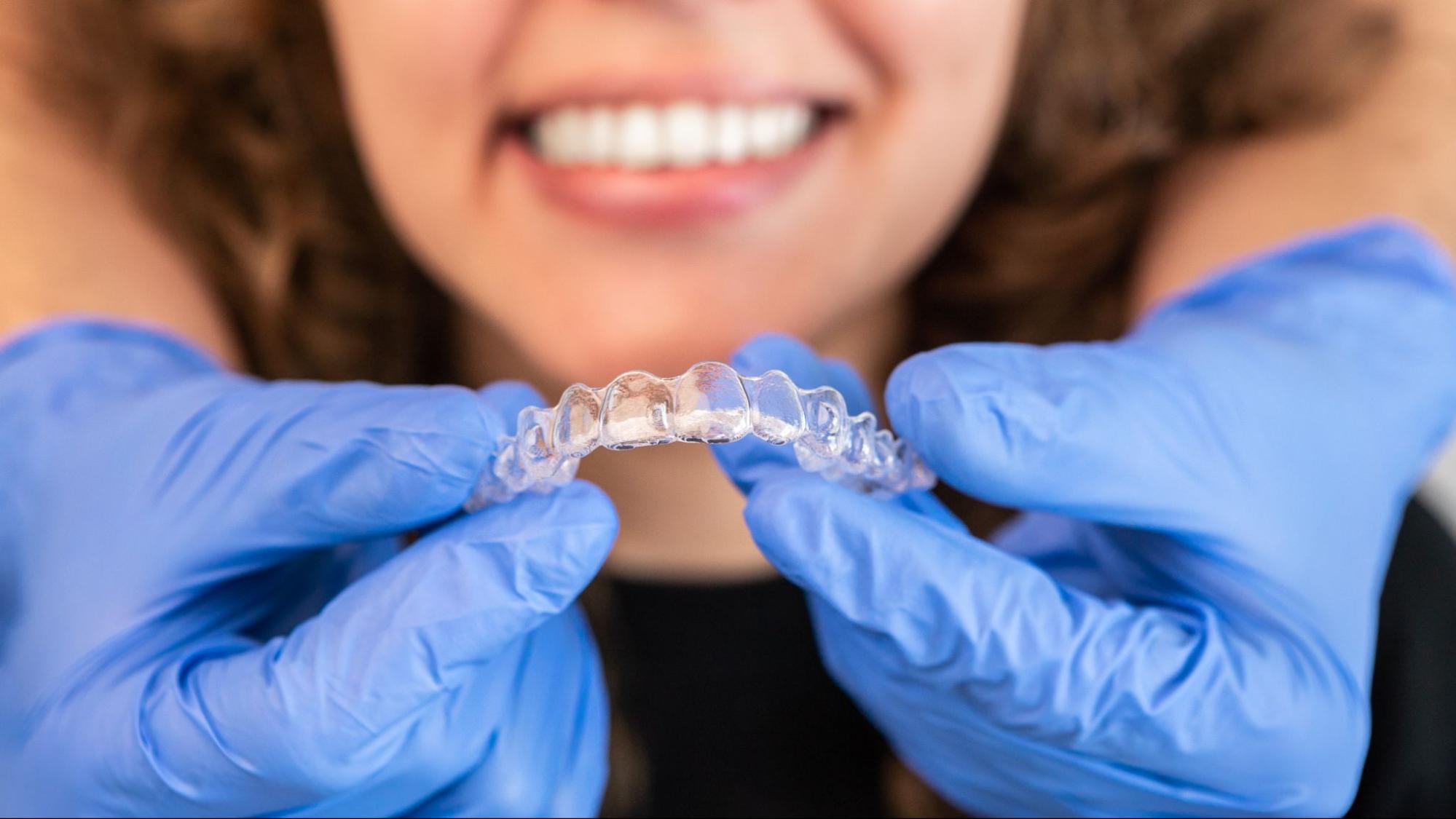 Retainers After Braces: A Complete Guide